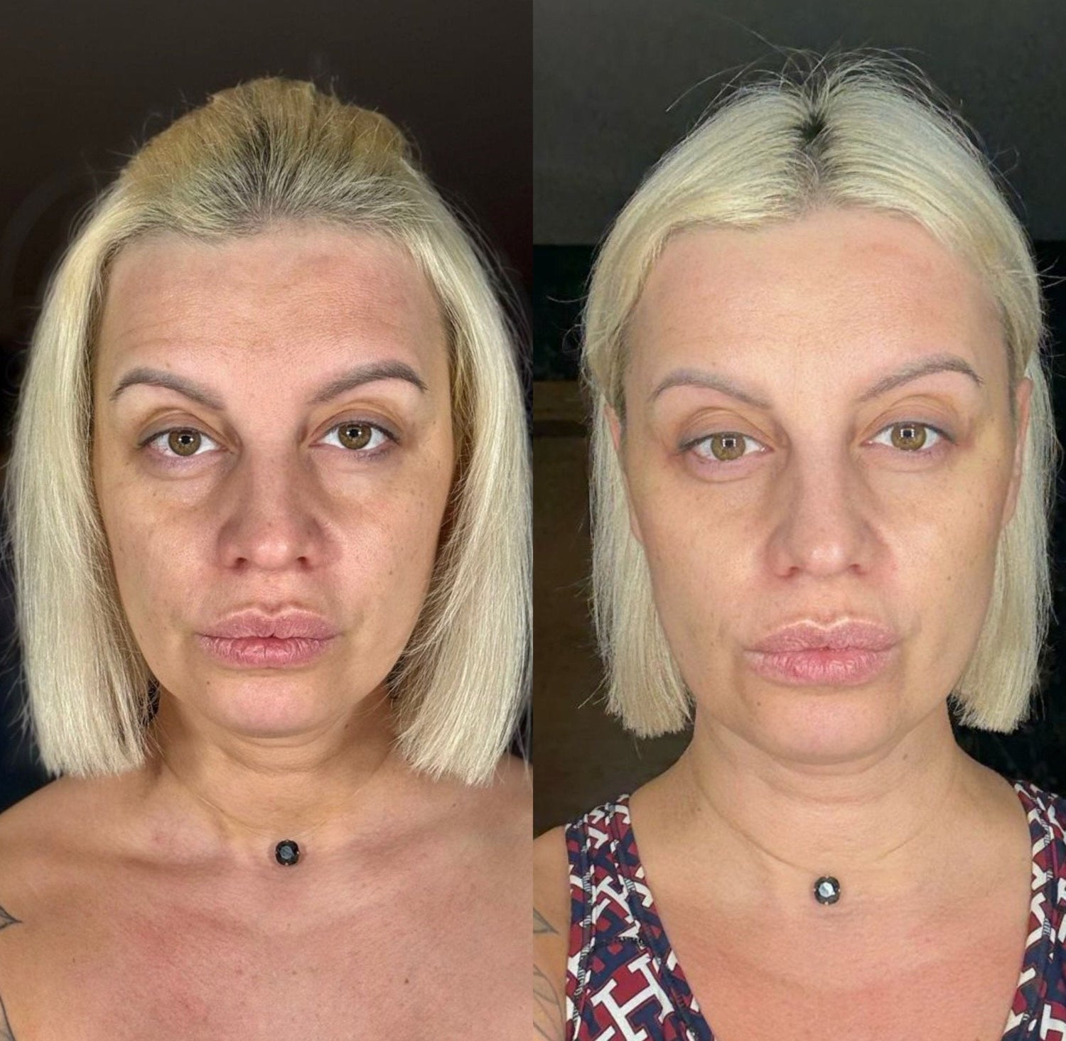 ABSOLUTE YOUTH – 2-Week Natural Anti-Aging Transformation