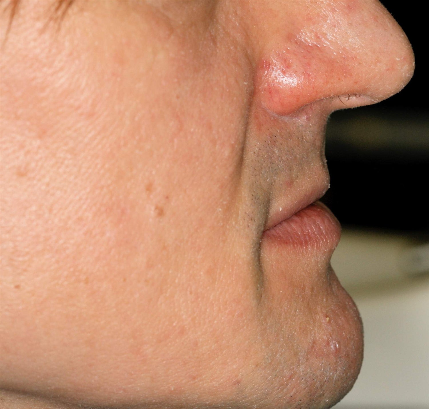 Your Face Ages As Much As Its Underlying Structures: What 30 Years in Surgery Taught Me About TMJ, Muscle Tension, and Natural Rejuvenation