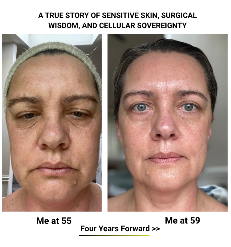 Sensitive but Stubborn? Why I Created ABSOLUTE YOUTH — After 15,000 Surgeries, I Refused to Burn My Own Skin